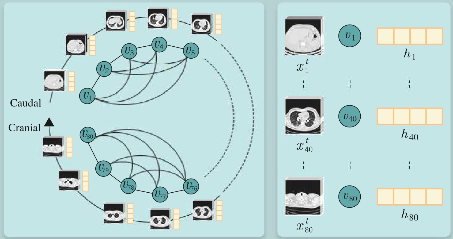 Structured Spectral Graph Learning for Abnormality Classification in 3D Chest CT Scans