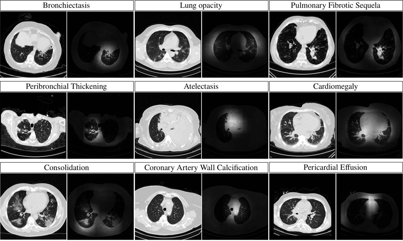Classification - Qualitative results